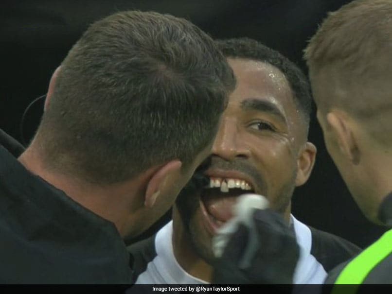 Premier League: Newcastle United Striker Callum Wilson Left With Tooth Hanging Out During Win vs Arsenal. See Pics