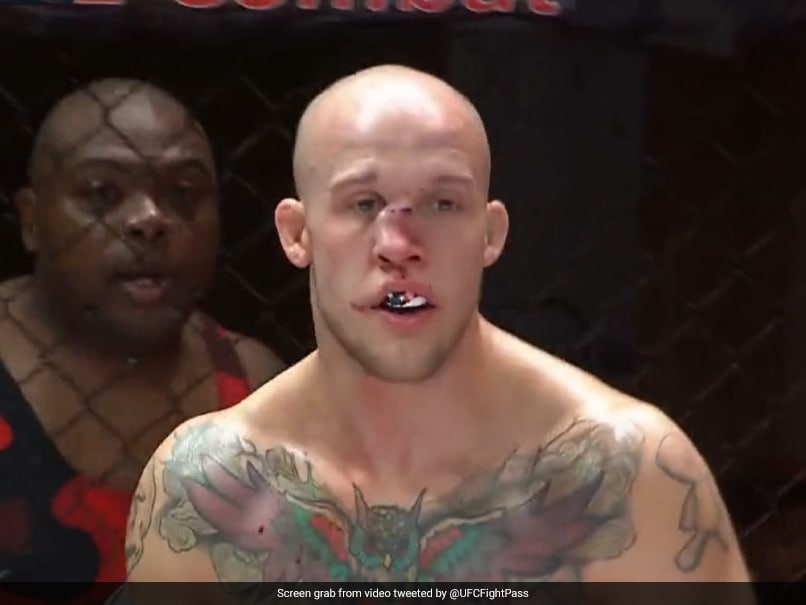 Video: MMA Fighter Suffers Horrific Nose Disfigurement After Taking Knee To Face