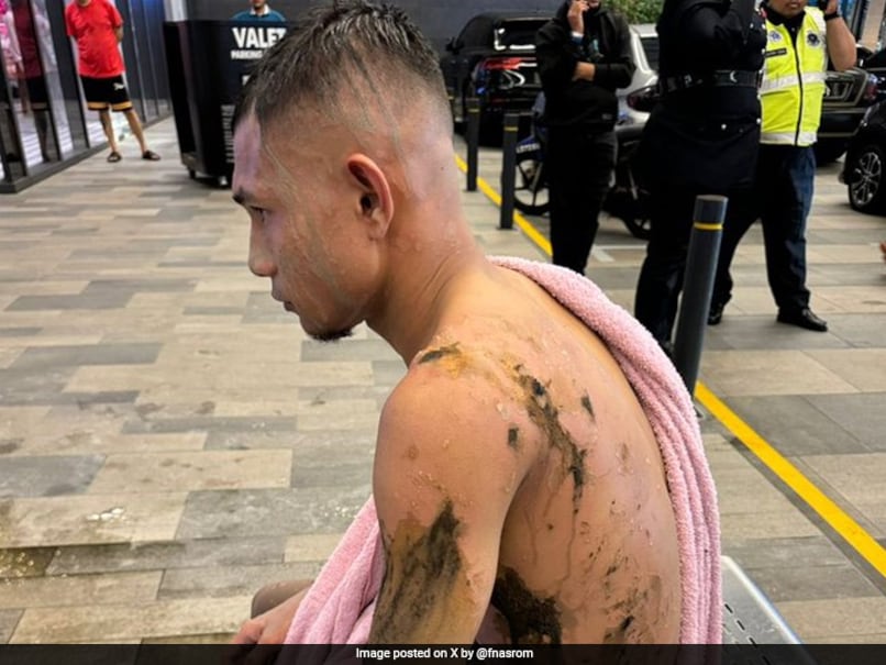 Malaysia Football Star Suffers Acid Attack Days After Assault On Teammate